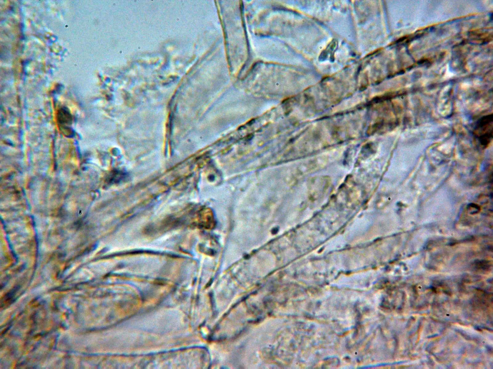 6 - Suprapellis agua 1